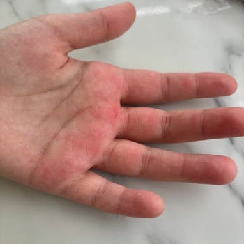 A101 Mağazasında Çocuğum Kaydı, Yaralandı Ve Personel Duyarsız Davrandı