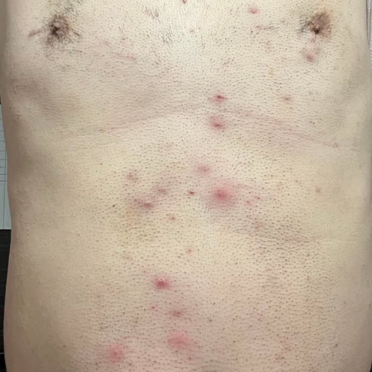 Kırıkkale Rönesans Vip Güzellik Salonu Lazer Seansı Sonrası Yaşanan Cilt Problemi!