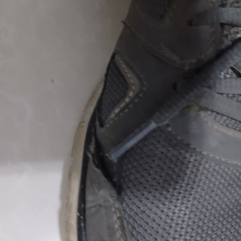 Skechers Ayakkabımın Dikişi 5 Ayda Atıyor, Değişim Talebim Reddedildi