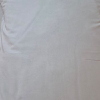 Hijyen Eksikliği Ve Kaba Personel Nedeniyle Otelde Para İadesi Talebi