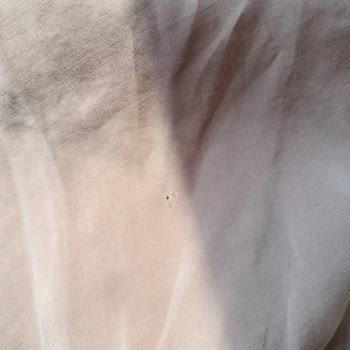 Defolu Tunik Ve İade Sürecindeki Uzun Bekleyiş