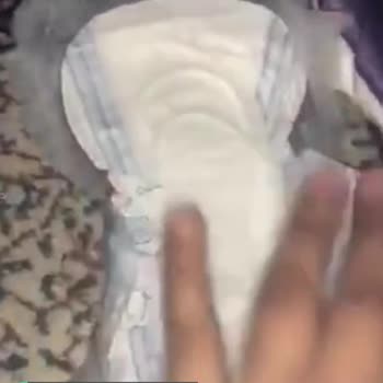 Molped Yapışkanı Pamuklu Bölgeye Yapışmış Kanatlarda Yapışkan Yok Hijyen Yok