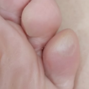 Ayak Sıkması Ve Su Toplaması Nedeniyle Değişim İsteği