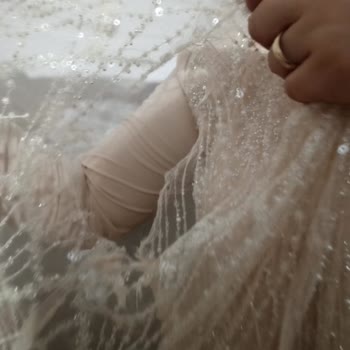 Yırtık Ve Yanık Kıyafetin İadesi, Kapora Ve Kargo Ücretleri Kesintisi