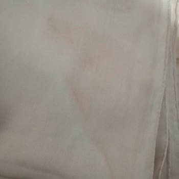 Yırtık Ve Yanık Kıyafetin İadesi, Kapora Ve Kargo Ücretleri Kesintisi