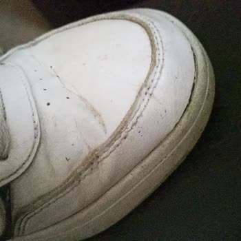 Beş Ayda Yırtılan Adidas Ayakkabı In Street’te Mağduriyetim Giderilmedi