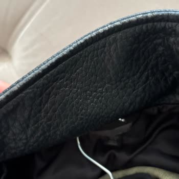 Zara Deri Cekette Kısa Sürede Deri Soyulması Ve Kalite Sorunu