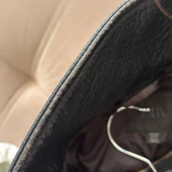 Zara Deri Cekette Kısa Sürede Deri Soyulması Ve Kalite Sorunu