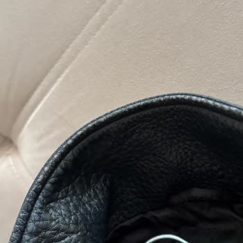 Zara Deri Cekette Kısa Sürede Deri Soyulması Ve Kalite Sorunu