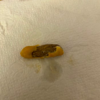 Sim Bat Marka Soslu Fıstıkta Yabancı Cisim Bulunması Sağlık Endişesi