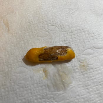 Sim Bat Marka Soslu Fıstıkta Yabancı Cisim Bulunması Sağlık Endişesi