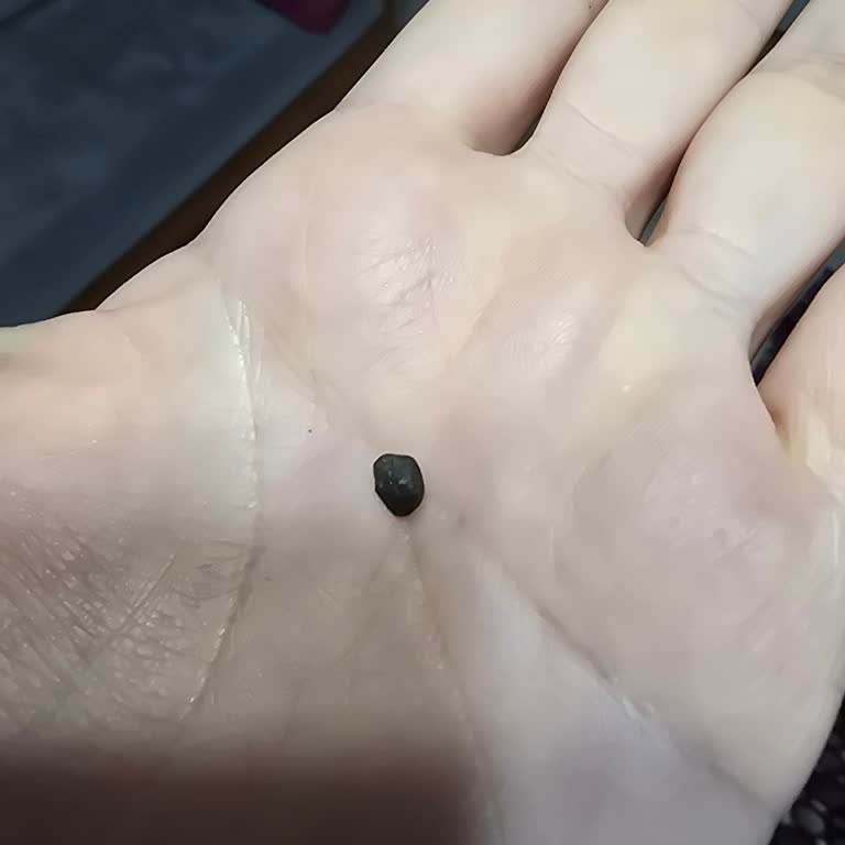 Kakao Nibli Bitter Dolgulu Bitter Çikolatada Taş Bulunması Dişi Neredeyse Kırdı