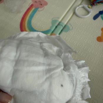 Sağlık Riski Taşıyan Bebek Bezi Ve Yetersiz Şirket Yanıtı