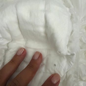 Sağlık Riski Taşıyan Bebek Bezi Ve Yetersiz Şirket Yanıtı