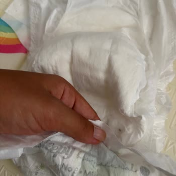 Sağlık Riski Taşıyan Bebek Bezi Ve Yetersiz Şirket Yanıtı