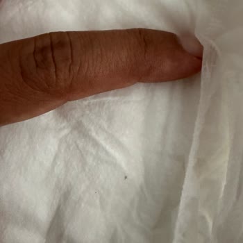 Sağlık Riski Taşıyan Bebek Bezi Ve Yetersiz Şirket Yanıtı