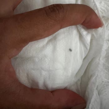 Sağlık Riski Taşıyan Bebek Bezi Ve Yetersiz Şirket Yanıtı