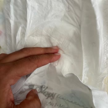 Sağlık Riski Taşıyan Bebek Bezi Ve Yetersiz Şirket Yanıtı