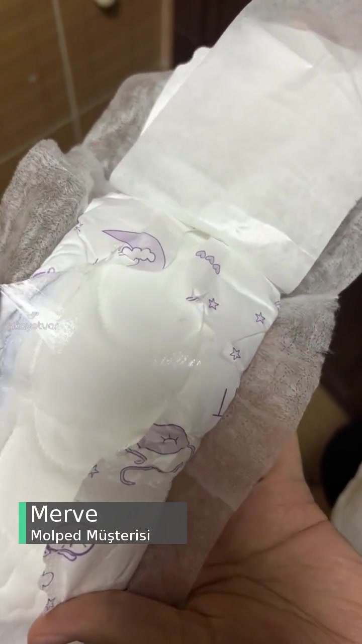 Molped Üretim Kaynaklı Yapışkan Sorunu videonun kapak resmi