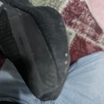 Orijinal Dediği Adidas Ultraboost Ayakkabısında Erken Aşınma Ve Ücretsiz Değişim Talebi