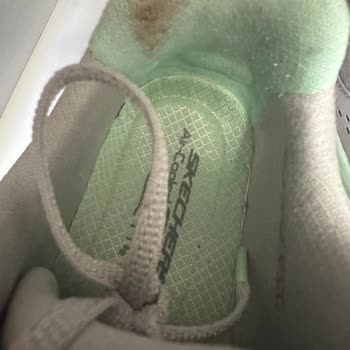 Skechers Ayakkabısının Topuk Yarası Nedeniyle Değişim İsteği