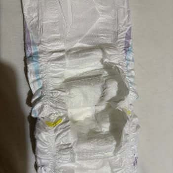Molfix Bebek Bezlerinde Lekeler: Kalite Kontrolü Şaibeli