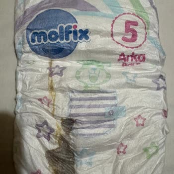 Molfix Bebek Bezlerinde Lekeler: Kalite Kontrolü Şaibeli