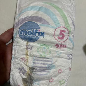 Molfix Bebek Bezlerinde Lekeler: Kalite Kontrolü Şaibeli