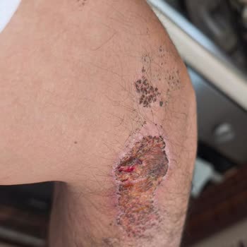 Arka Jant Fabrikadan Çöktü, Ağır Kaza Ve Sağlık Kaybı - DeFactoFIT Sorumlu