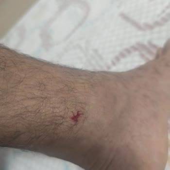 Arka Jant Fabrikadan Çöktü, Ağır Kaza Ve Sağlık Kaybı - DeFactoFIT Sorumlu