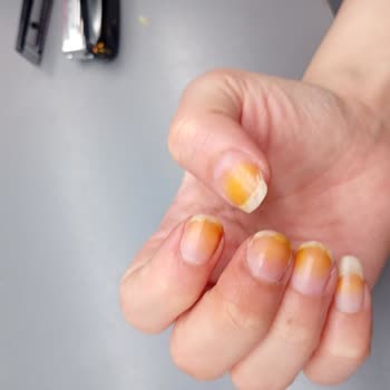 Pastel 341 Yeşil Oje Sarı Leke Bıraktı Ve Sağlık Endişesi
