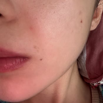 Yeni Formül Jeuvenile Kremi Ciltte Olumsuz Etki Yaratıyor, Ayıplı Ürün Talebi