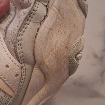 Garanti Süresinde Açılan Skechers Ayakkabının Değişimi Ve İadesi Talebi