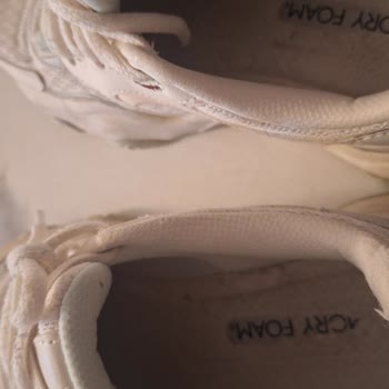 Garanti Süresinde Açılan Skechers Ayakkabının Değişimi Ve İadesi Talebi