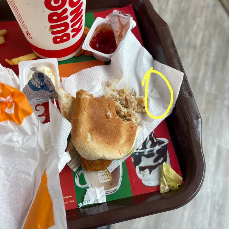 Burger King Menüsünde Plastik Parça: Sağlık Endişesi Ve Yetersiz Çözüm