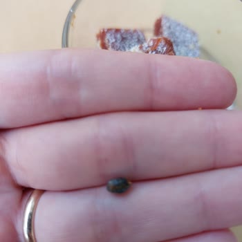 Cezerye İçinde Taş Bulunması Ve Gıda Güvenliği İhmaline Tepki