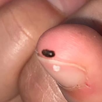 Kaya Tuzunda Böcek Görülmesi Ve Gıda Güvenliği Endişesi