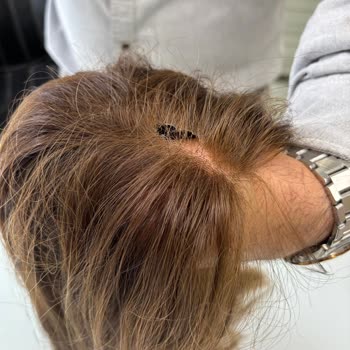 Peruk Yıkanırken Yırtıldı, Yama Belirgin Ve Çözüm Sunulmadı