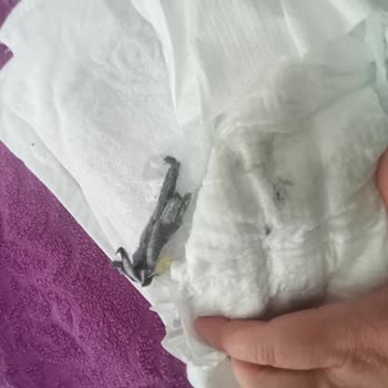 Molfix Bebek Bezinde Siyah Parçalar Ve Kalite Kontrol Sorunu