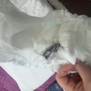Molfix Bebek Bezinde Siyah Parçalar Ve Kalite Kontrol Sorunu