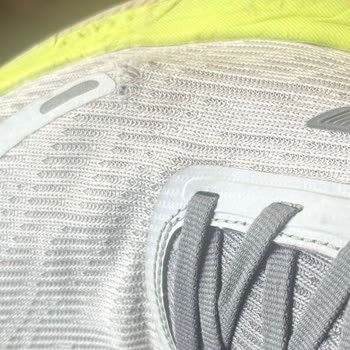 Skechers Spor Ayakkabısında Yan Yırtılma Ve Mağazanın Destek Vermemesi