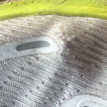 Skechers Spor Ayakkabısında Yan Yırtılma Ve Mağazanın Destek Vermemesi