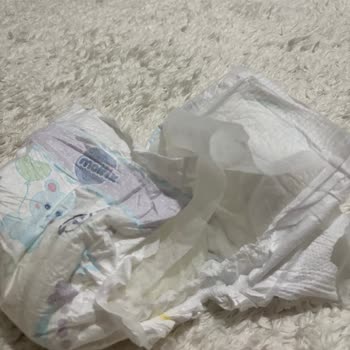 Molfix Bezinin İç Dolgu Ayrılması Ve Şiddetli Pişik Sorunu