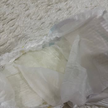 Molfix Bezinin İç Dolgu Ayrılması Ve Şiddetli Pişik Sorunu
