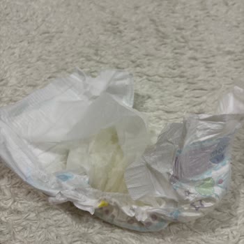 Molfix Bezinin İç Dolgu Ayrılması Ve Şiddetli Pişik Sorunu