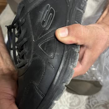 Skechers Ayakkabısının Kısa Sürede Açılması Ve Şirketin Haksız Red Cevabı