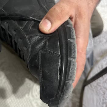 Skechers Ayakkabısının Kısa Sürede Açılması Ve Şirketin Haksız Red Cevabı