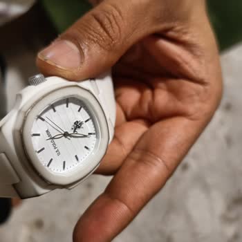 Kadran Soyulması Nedeniyle Saat Ayıplı Ürün Olarak İade Talebi