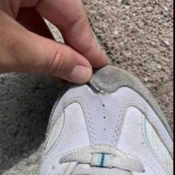 Skechers Ayakkabılarda Kısa Sürede Açılma Ve Deformasyon Sorunu
