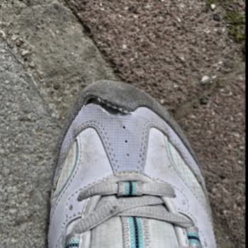Skechers Ayakkabılarda Kısa Sürede Açılma Ve Deformasyon Sorunu